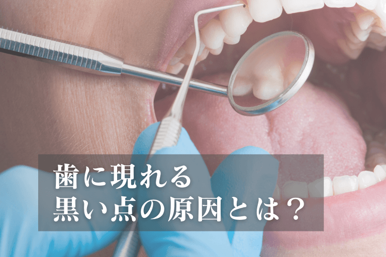 歯に現れる黒い点の原因とは？